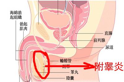 早期判断急性精囊炎 避免更多麻烦
