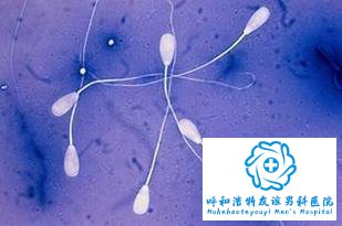 睡眠不足也是精液不液化的一大诱因？