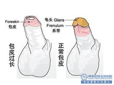 治疗霉菌性龟头炎