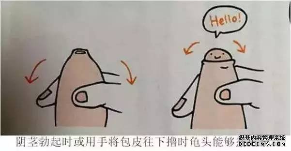 齐齐哈尔异味、感染、性交疼痛，早泄是不是割了包皮就会好? 