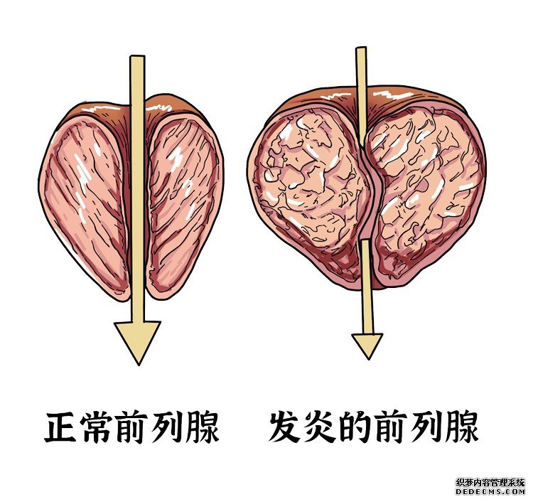 男人如何保养好前列腺？4件事引来“前列腺炎”，懂的人都不会碰